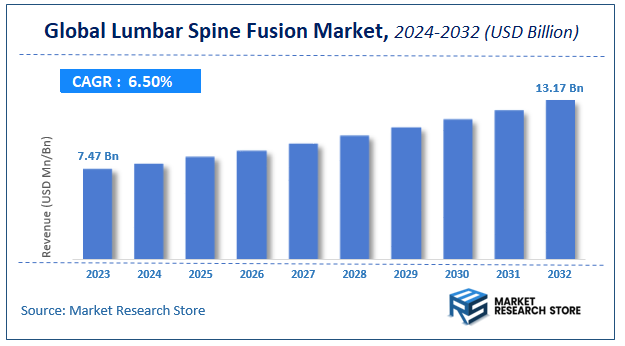 Lumbar Spine Fusion Market Size