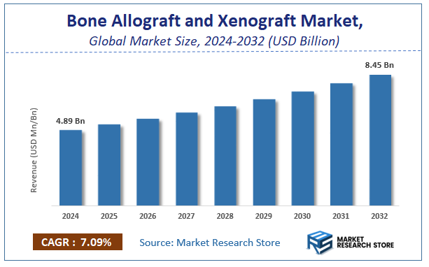 Bone Allograft and Xenograft Market Size